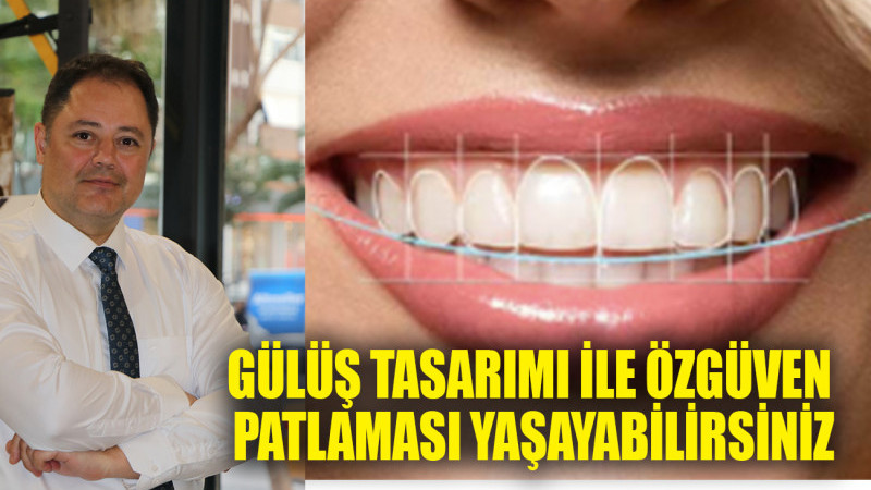 HOLLYWOOD YILDIZLARI GİBİ GÜLMEK İSTER MİSİNİZ?